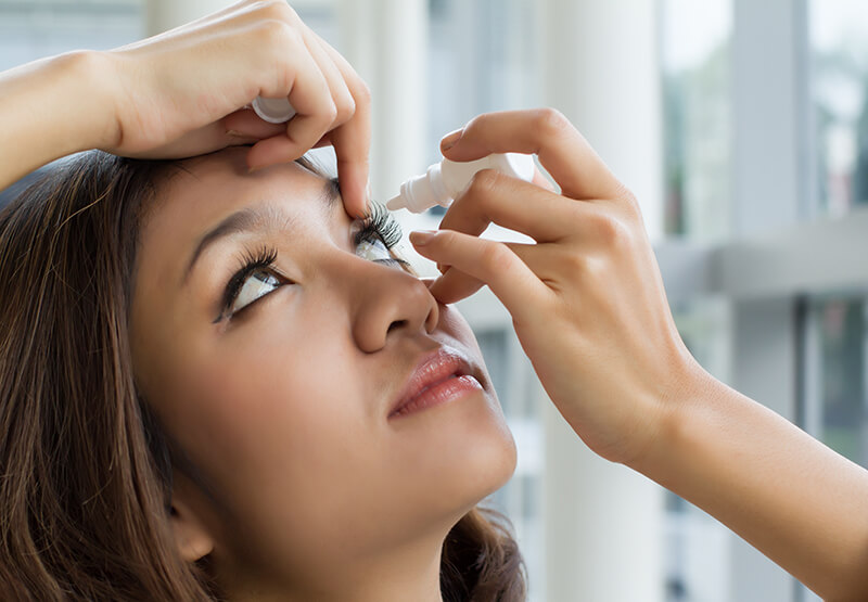 Woman Putting Eyedrops Into Her Eye